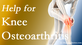 Johnson Chiropractic shares recent studies regarding the exercise recommendations for knee osteoarthritis relief, even exercising the healthy knee for relief in the painful knee!