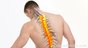 Richmond thoracic spine pain image