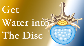 Johnson Chiropractic uses spinal manipulation and exercise to enhance the diffusion of water into the disc which supports the health of the disc.