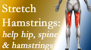 Johnson Chiropractic promotes back pain patients to stretch hamstrings for length, range of motion and flexibility to support the spine.