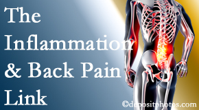 Johnson Chiropractic tackles the inflammatory process that accompanies back pain as well as the pain itself.