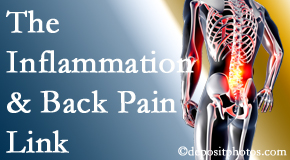 Johnson Chiropractic addresses the inflammatory process that accompanies back pain as well as the pain itself.