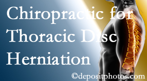 Johnson Chiropractic diagnoses and manages thoracic disc herniation pain and relieves its symptoms like unexplained abdominal pain or other gastrointestinal issues. 