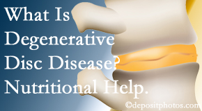 Johnson Chiropractic treats degenerative disc disease with chiropractic treatment and nutritional interventions. 