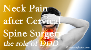 Johnson Chiropractic offers gentle treatment for neck pain after neck surgery.