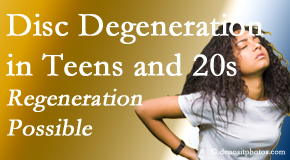 Johnson Chiropractic relieves back pain due to disc degeneration in younger people in their teens and 20s.