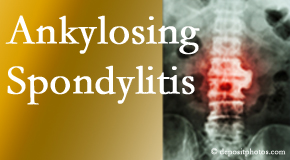 Ankylosing spondylitis is gently cared for by your Richmond chiropractor.