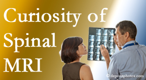 Richmond MRIs for spinal stenosis may be revealing…or confusing.