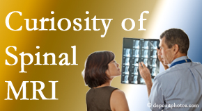 Richmond MRIs for spinal stenosis may be revealing…or puzzling.