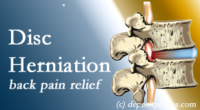 Johnson Chiropractic offers non-surgical treatment for relief of disc herniation related back pain.
