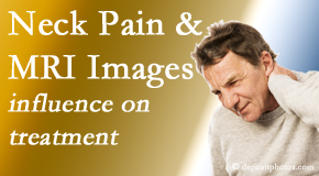 Johnson Chiropractic considers MRI findings like Modic Changes when setting up a neck pain relieving treatment plan.