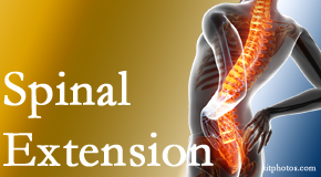 Johnson Chiropractic knows the role of extension in spinal motion, its necessity, its benefits and potential harmful effects. 