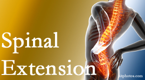 Johnson Chiropractic understands the role of extension in spinal motion, its necessity, its benefits and potential harmful effects. 