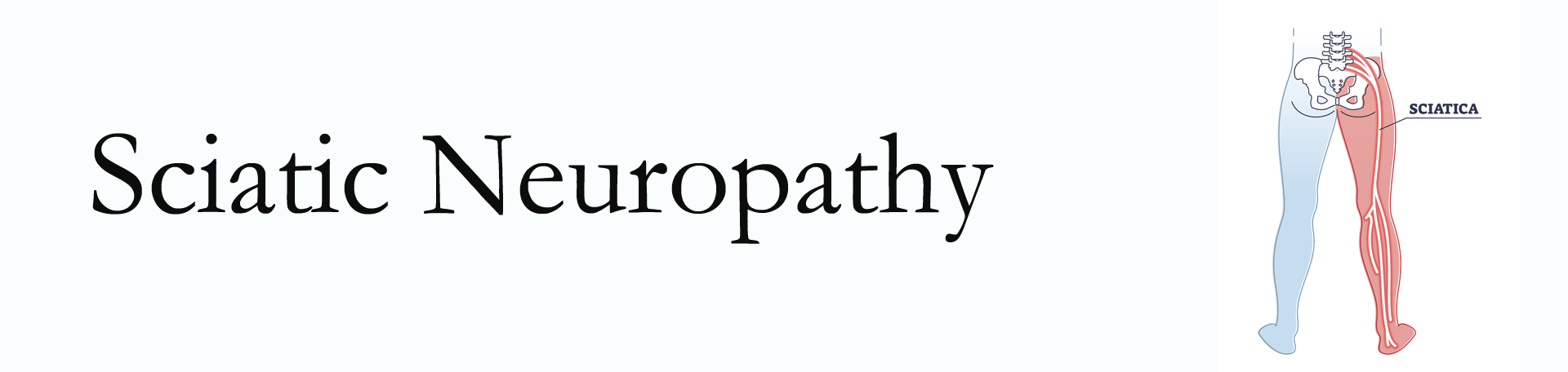 Richmond neuropathy pain (sciatica)
