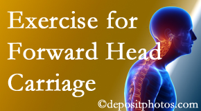 Richmond chiropractic treatment of forward head carriage is two-fold: manipulation and exercise.