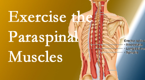 Johnson Chiropractic explains the importance of paraspinal muscles and their strength for Richmond back pain relief.
