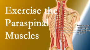 Johnson Chiropractic describes the importance of paraspinal muscles and their strength for Richmond back pain relief.