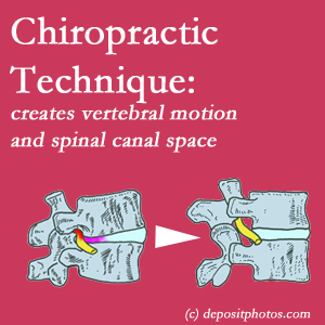 picture of a Richmond spinal stenotic canal