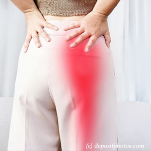 image of Richmond leg pain, sciatica, lumbar radiculopathy