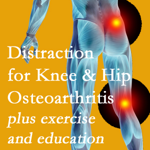 A chiropractic treatment plan for Richmond knee pain and hip pain due to osteoarthritis: education, exercise, distraction.