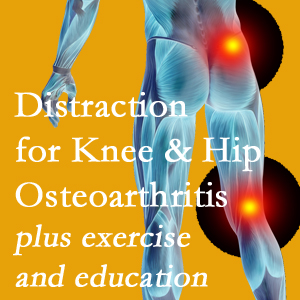 A chiropractic treatment plan for Richmond knee pain and hip pain caused by osteoarthritis: education, exercise, distraction.