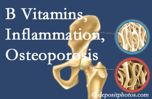 Richmond chiropractic care of osteoporosis often comes with nutritional tips like b vitamins for inflammation reduction and for prevention.