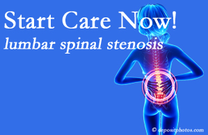 Johnson Chiropractic shares research that emphasizes that non-operative treatment for spinal stenosis within a month of diagnosis is beneficial. 