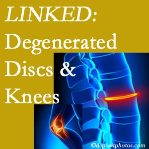 Degenerated discs and degenerated knees are not such strange bedfellows. They are seen to be related. Richmond patients with a loss of disc height due to disc degeneration often also have knee pain related to degeneration.  