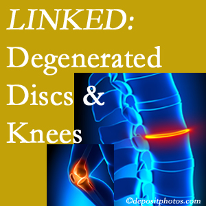 Degenerated discs and degenerated knees are not such unlikely companions. They are seen to be related. Richmond patients with a loss of disc height due to disc degeneration often also have knee pain related to degeneration. 