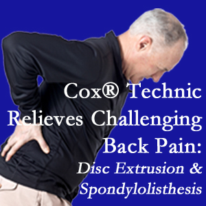 Richmond chiropractic care with Cox Technic alleviates back pain due to a painful combination of a disc extrusion and a spondylolytic spondylolisthesis.