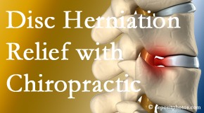 Johnson Chiropractic gently treats the disc herniation causing back pain.
